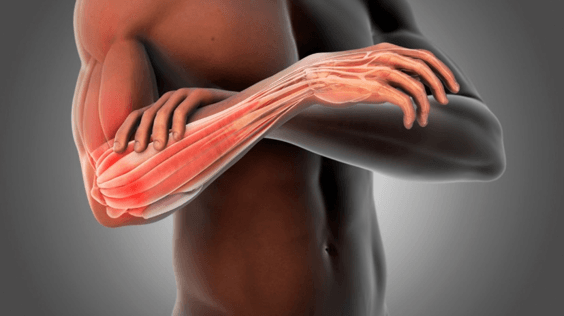 Tennis Elbow Tennis Elbow